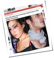 Amy Winehouse: Blutige Pr&uuml;gelei mit Ehemann
