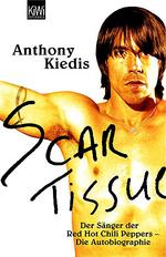 Anthony Kiedis: