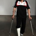 Liverpool-Aus - Campino bricht sich Fuß an Mülltonne
